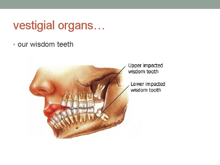 vestigial organs… • our wisdom teeth 