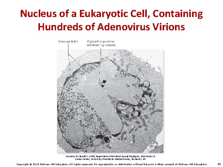 Nucleus of a Eukaryotic Cell, Containing Hundreds of Adenovirus Virions Courtesy Dr. Harold C.