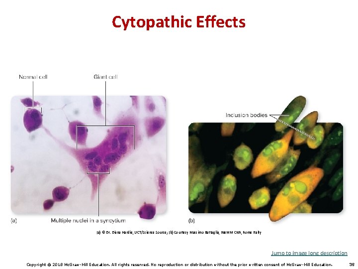 Cytopathic Effects (a) © Dr. Diana Hardie, UCT/Science Source; (b) Courtesy Massimo Battaglia, INe.