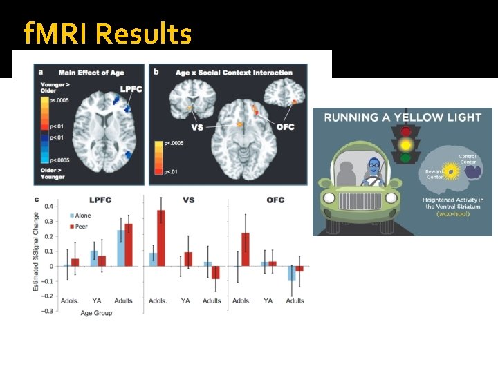 f. MRI Results 