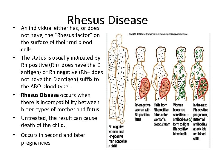  • Rhesus Disease An individual either has, or does not have, the "Rhesus