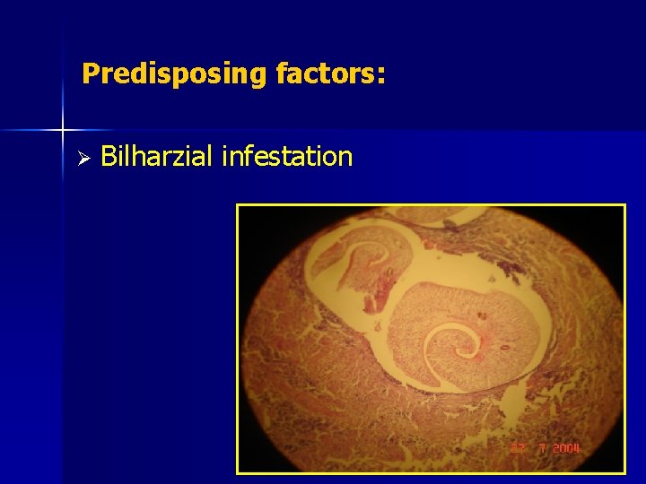 Predisposing factors: Ø Bilharzial infestation 