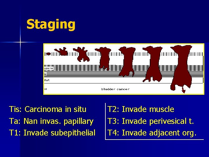 Staging Tis: Carcinoma in situ Ta: Nan invas. papillary T 1: Invade subepithelial T