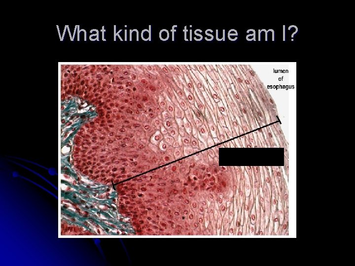 What kind of tissue am I? 