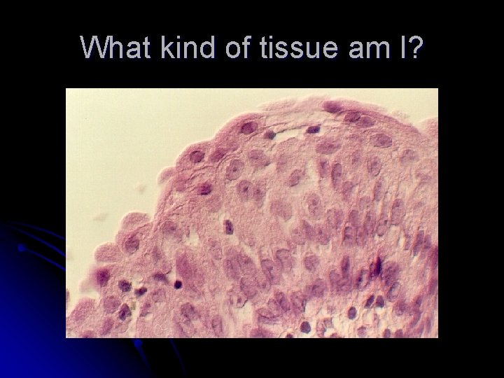 What kind of tissue am I? 