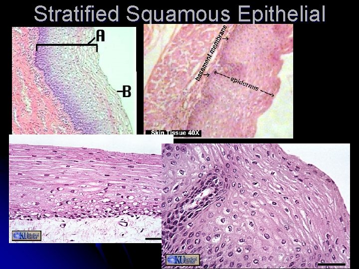 Stratified Squamous Epithelial 