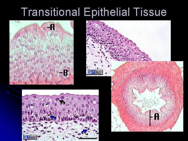 Transitional Epithelial Tissue 
