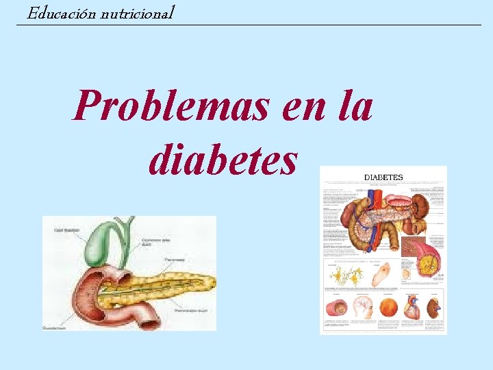 Educación nutricional Problemas en la diabetes 