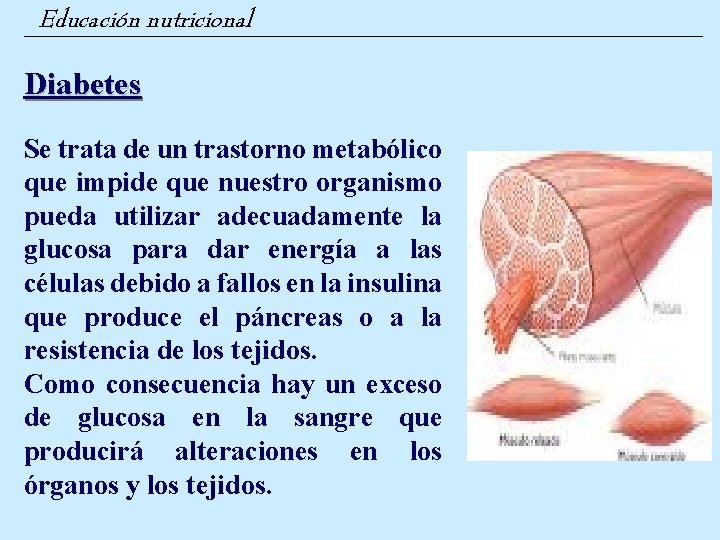 Educación nutricional Diabetes Se trata de un trastorno metabólico que impide que nuestro organismo