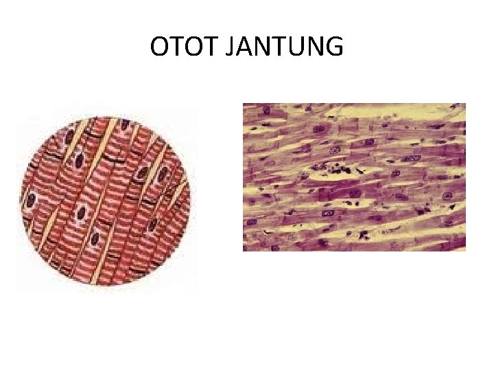 OTOT JANTUNG 