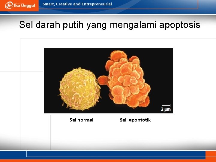 Sel darah putih yang mengalami apoptosis Sel normal Sel apoptotik 