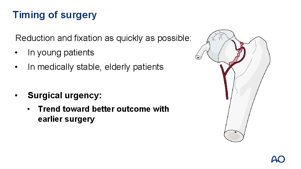 Timing of surgery Reduction and fixation as quickly as possible: • In young patients