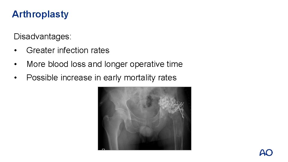 Arthroplasty Disadvantages: • Greater infection rates • More blood loss and longer operative time