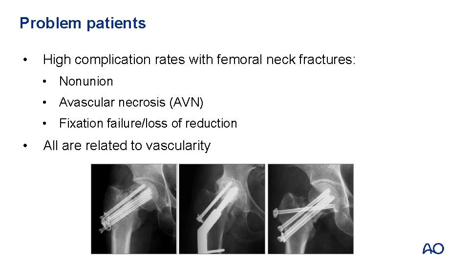 Problem patients • High complication rates with femoral neck fractures: • Nonunion • Avascular