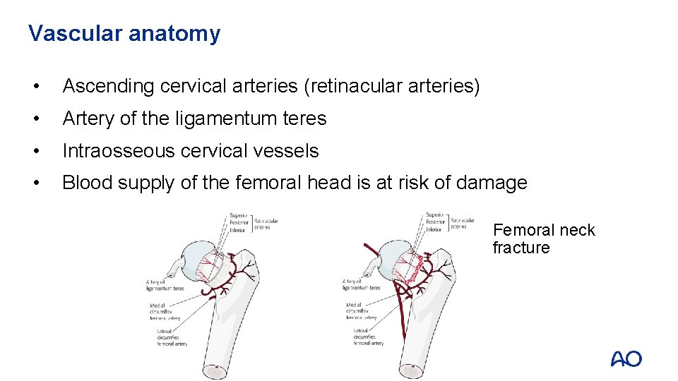 Vascular anatomy • Ascending cervical arteries (retinacular arteries) • Artery of the ligamentum teres