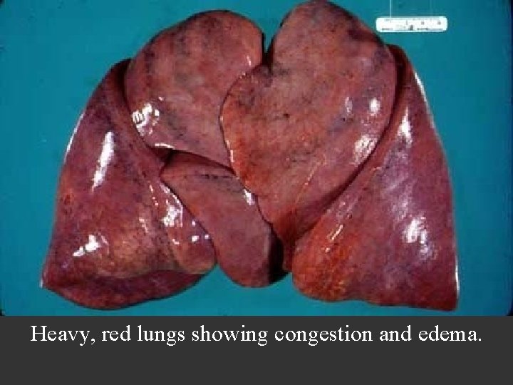 Heavy, red lungs showing congestion and edema. 