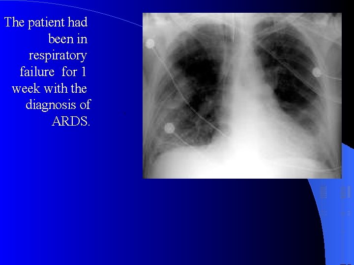 The patient had been in respiratory failure for 1 week with the diagnosis of