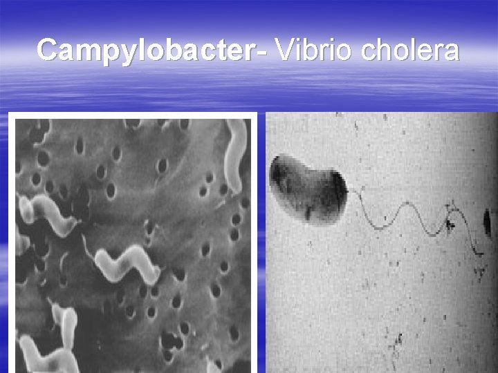 Campylobacter- Vibrio cholera 