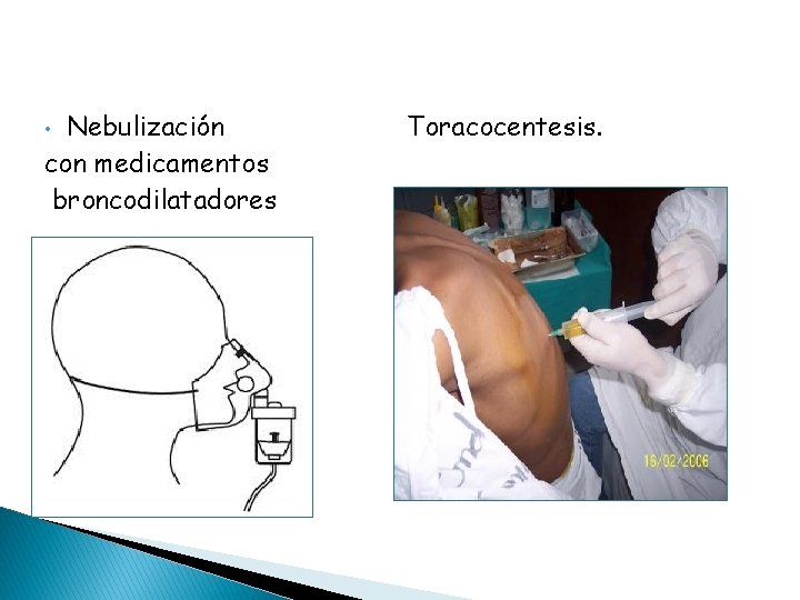 Nebulización con medicamentos broncodilatadores • Toracocentesis. 