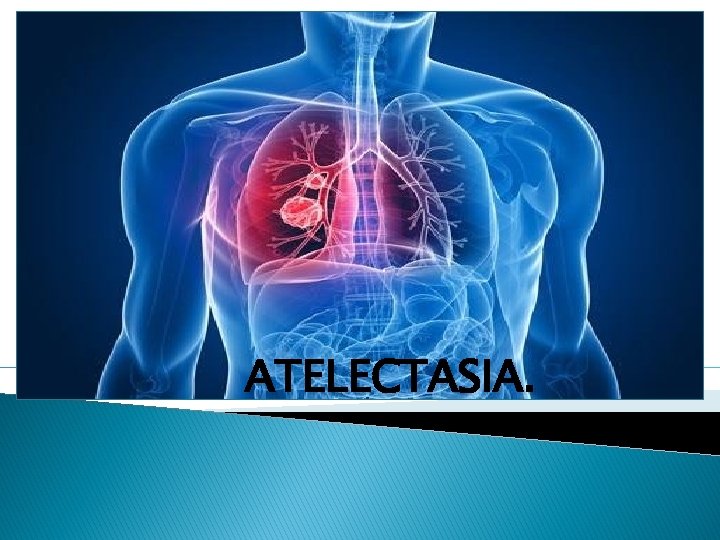 ATELECTASIA. 