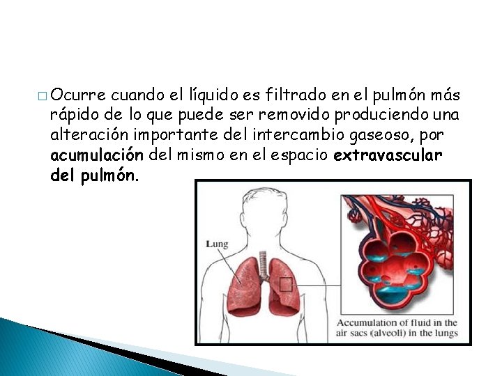 � Ocurre cuando el líquido es filtrado en el pulmón más rápido de lo