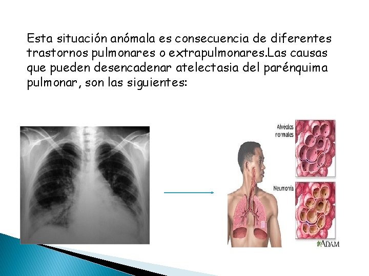 Esta situación anómala es consecuencia de diferentes trastornos pulmonares o extrapulmonares. Las causas que