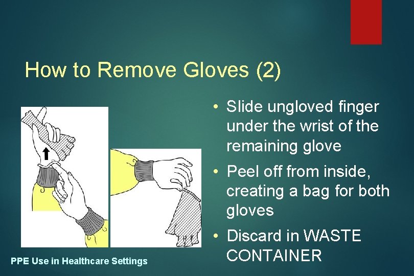 How to Remove Gloves (2) • Slide ungloved finger under the wrist of the