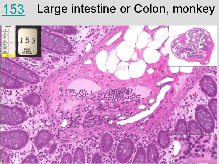 153 Large intestine or Colon, monkey 
