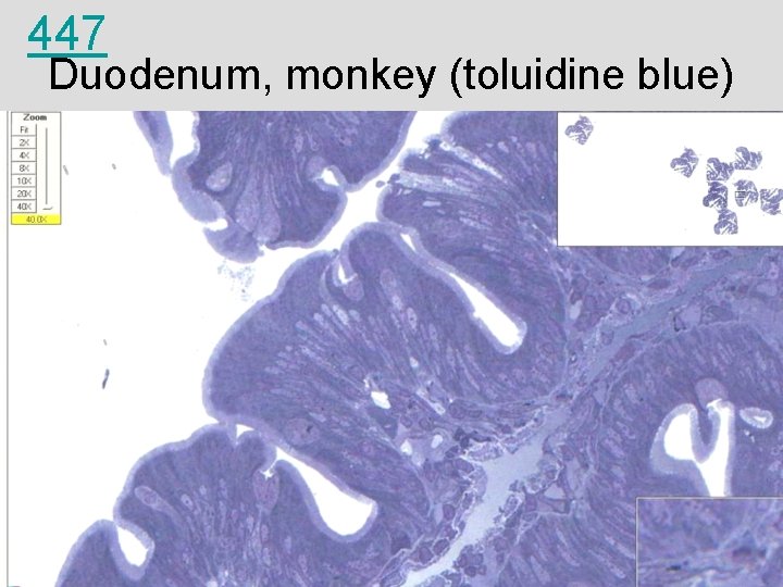 447 Duodenum, monkey (toluidine blue) 