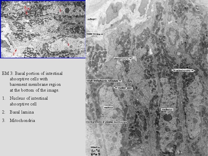 EM 3: Basal portion of intestinal absorptive cells with basement membrane region at the