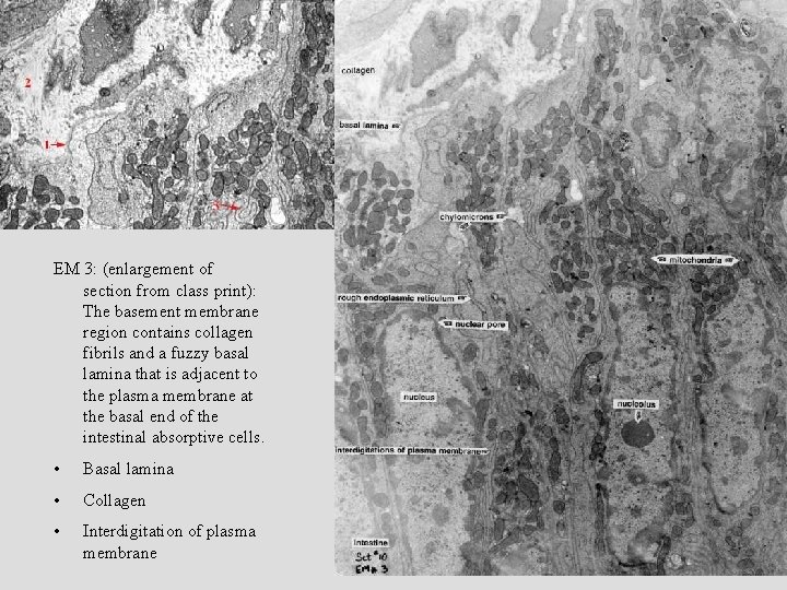 EM 3: (enlargement of section from class print): The basement membrane region contains collagen