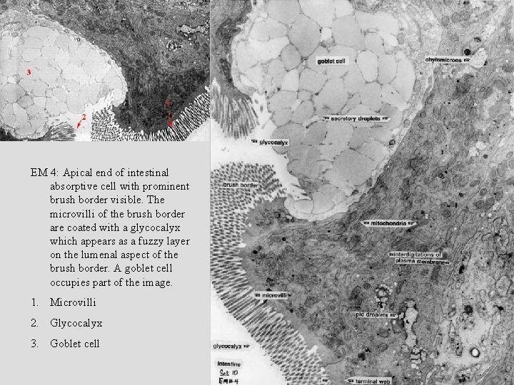 EM 4: Apical end of intestinal absorptive cell with prominent brush border visible. The