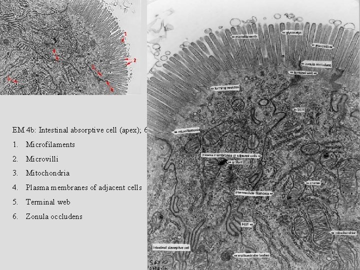 EM 4 b: Intestinal absorptive cell (apex); 60, 000 x. 1. Microfilaments 2. Microvilli