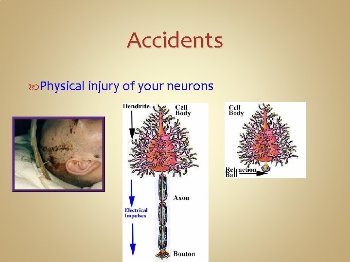 Accidents Physical injury of your neurons 