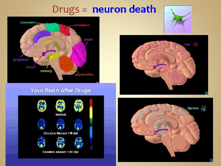 Drugs = neuron death 