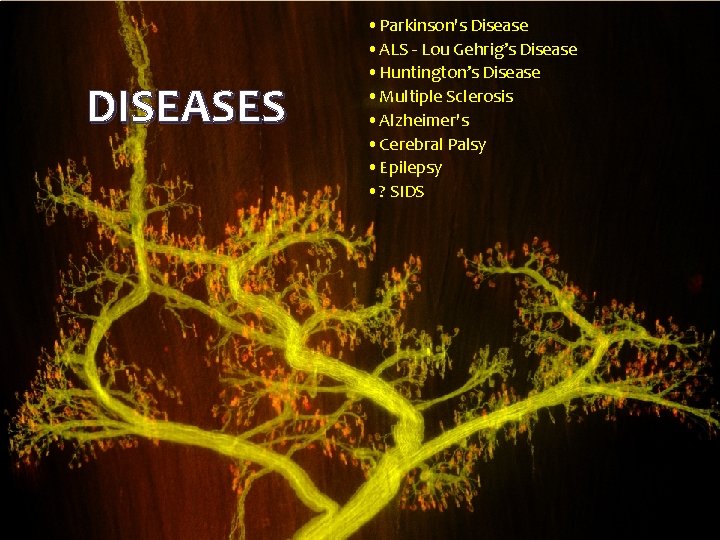 DISEASES • Parkinson's Disease • ALS - Lou Gehrig’s Disease • Huntington’s Disease •
