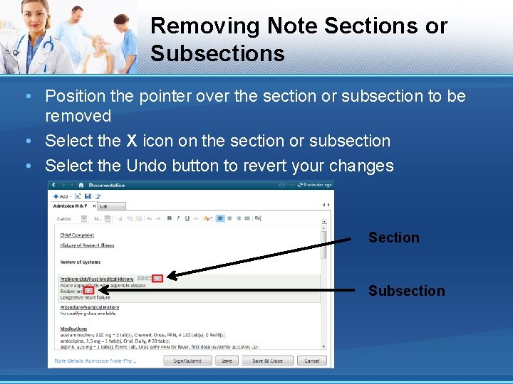 Removing Note Sections or Subsections • Position the pointer over the section or subsection