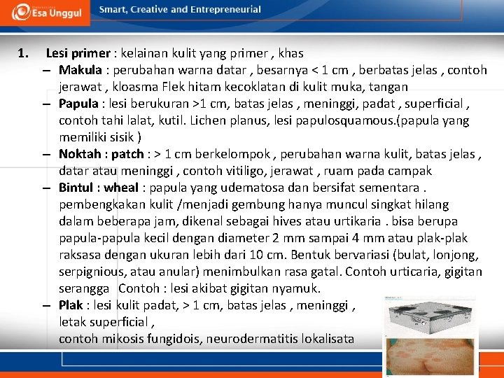 1. Lesi primer : kelainan kulit yang primer , khas – Makula : perubahan