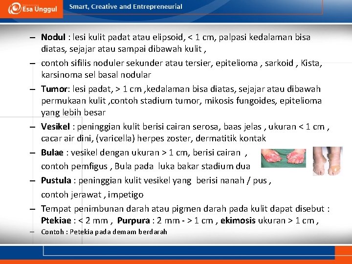 – Nodul : lesi kulit padat atau elipsoid, < 1 cm, palpasi kedalaman bisa