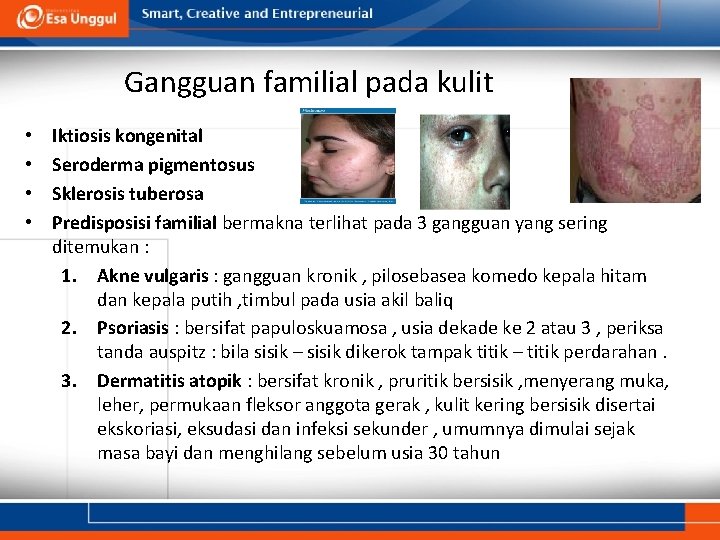 Gangguan familial pada kulit • • Iktiosis kongenital Seroderma pigmentosus Sklerosis tuberosa Predisposisi familial