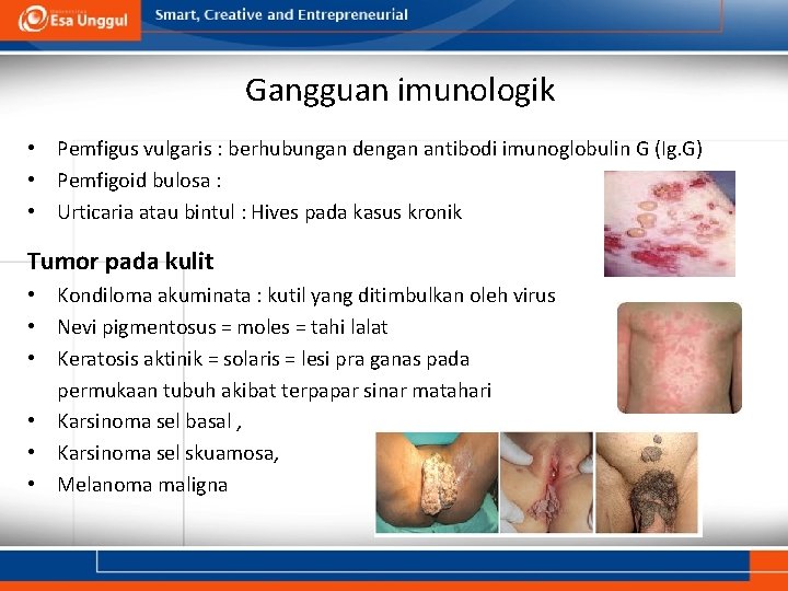 Gangguan imunologik • Pemfigus vulgaris : berhubungan dengan antibodi imunoglobulin G (Ig. G) •