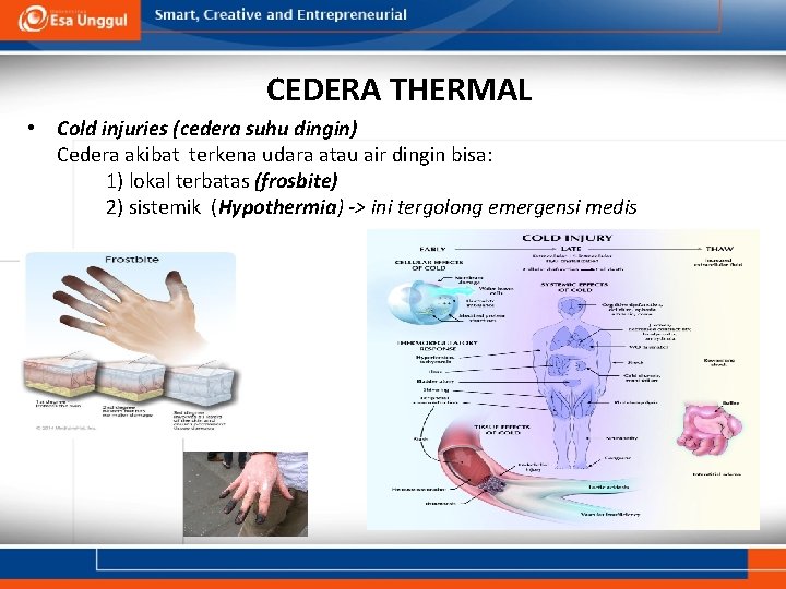 CEDERA THERMAL • Cold injuries (cedera suhu dingin) Cedera akibat terkena udara atau air