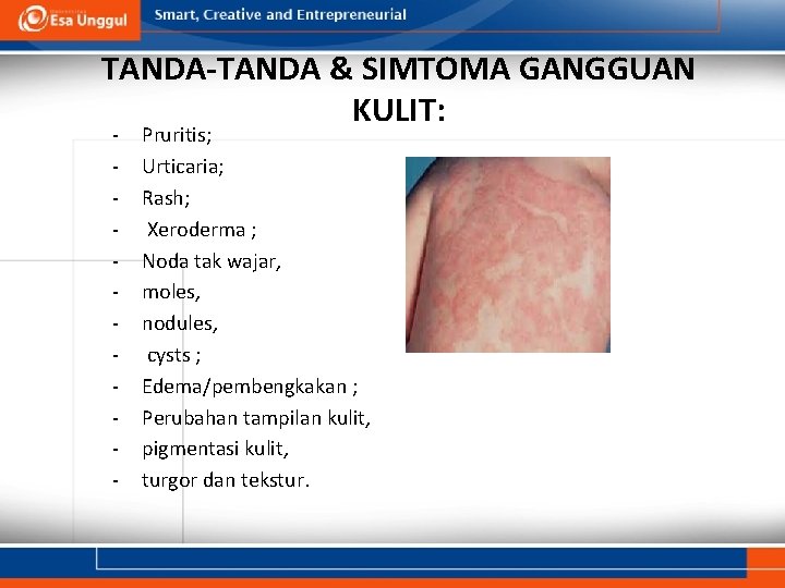 TANDA-TANDA & SIMTOMA GANGGUAN KULIT: - Pruritis; Urticaria; Rash; Xeroderma ; Noda tak wajar,