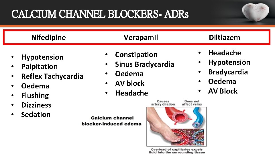 CALCIUM CHANNEL BLOCKERS- ADRs Nifedipine • • Hypotension Palpitation Reflex Tachycardia Oedema Flushing Dizziness