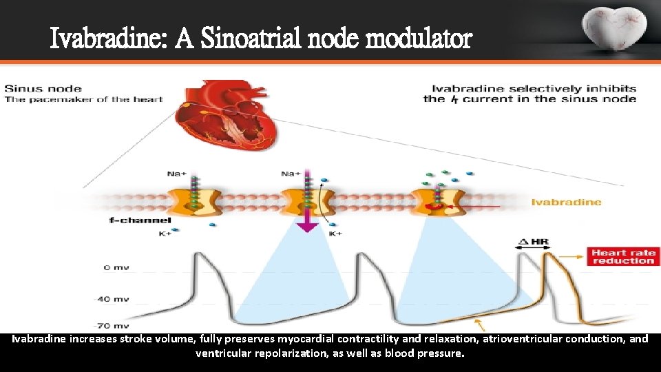 Ivabradine: A Sinoatrial node modulator Ivabradine increases stroke volume, fully preserves myocardial contractility and