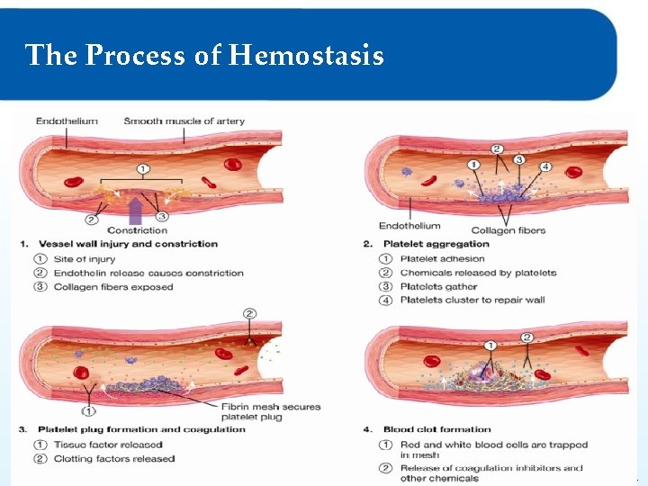 The Process of Hemostasis © Goodheart-Willcox Co. , Inc. Permission granted to reproduce for
