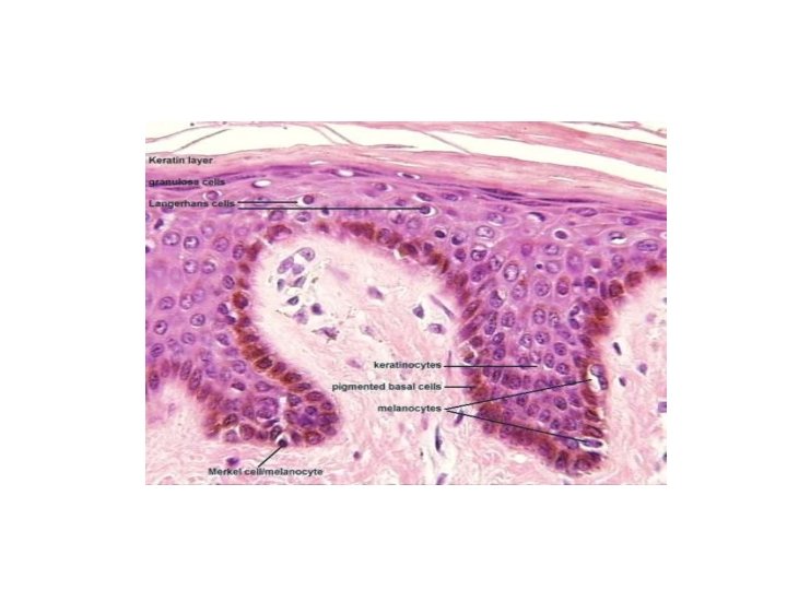 TYPESOFOF EPIDERTYPES OFOF EPIDERMAL • TYPES EPIDERMAL CELLSSEEE ﺙ CELLSMAL CELLS ﺛﺜﺚ 