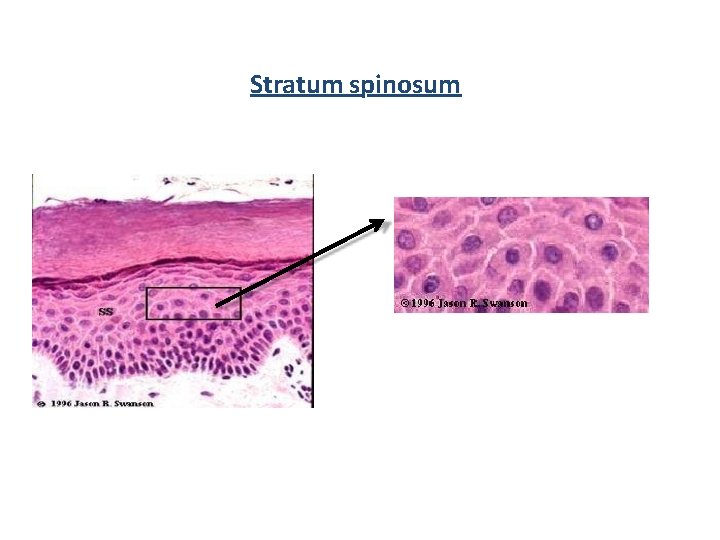 Stratum spinosum 