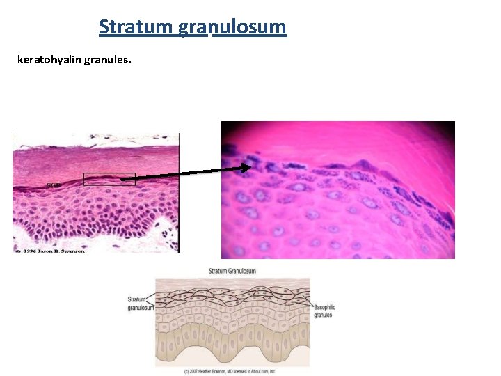 Stratum granulosum keratohyalin granules. 