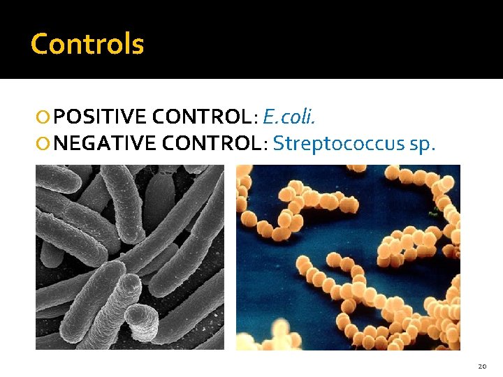 Controls POSITIVE CONTROL: E. coli. NEGATIVE CONTROL: Streptococcus sp. 20 